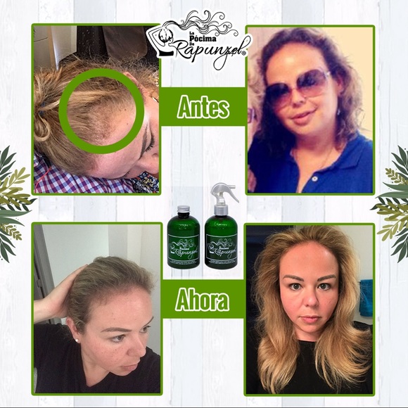 Shampoo - Picture 4 of 7